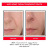 Microcurrent Facial Toning Device