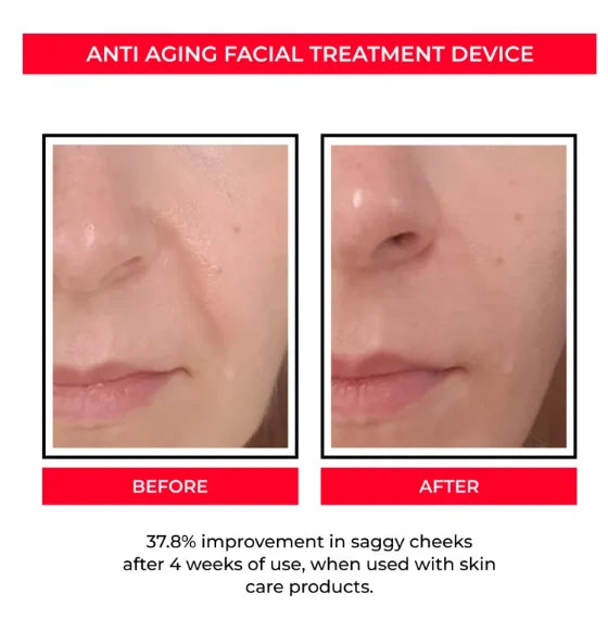 Microcurrent Facial Toning Device